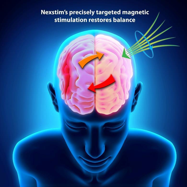 NBT -laitteiston toiminta aivohalvauspotilaiden kuntoutuksessa Validoidussa sähkökenttään perustuvassa navigoinnissa stimulointi on toistettavaa ja kohdennettua, mikä antaa kilpailuetua Nexstimin