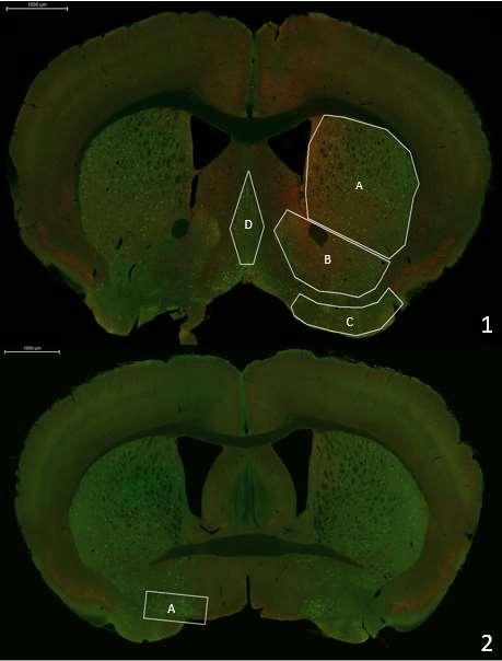 5 2.3 Aivoalueet Kuvassa 3 näkyy aivojen etuosasta tutkittaviksi alueiksi valittujen striatumin, nucleus accumbenssin, olfactory tuberculen, septumin ja BT:n sijainnit leikkeellä sekä leikkeen