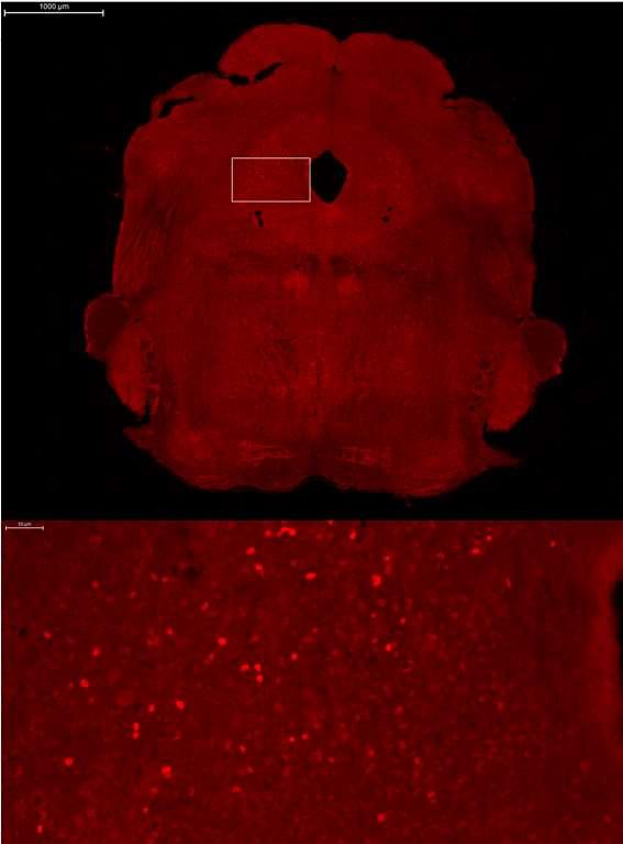 Kuva 5: Hiiren aivokudoksen c-fos-proteiinin vasta-ainevärjäys, aallonpituus 594 nm.