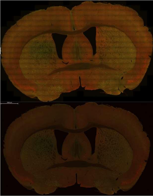 16 3.3 Fluoresenssimikroskopointi, kuvankäsittely ja solujen laskenta Leikkeet kuvattiin ensin käyttäen Zeiss Axio Imager -mikroskooppia.