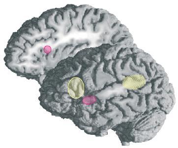 Puheen syntaksin käsittely aivoissa Puheessa syntaktiset virheet saavat aikaa ns. early left anterior negativity (ELAN) ja P600-vasteet.