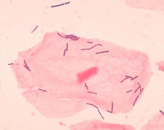 9. Probiootit ihmisen terveyttä edistävät bakteerit pro = puolesta biotic = elävä, elävien organismien aikaansaama tuotetaan nykyään laboratorioissa eläviä mikrobeja, jotka edistävät ihmisen