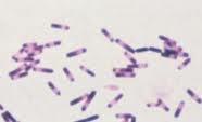 C. difficile Gram-positiivinen, anaerobinen, itiöivä sauva toksiinia tuottava