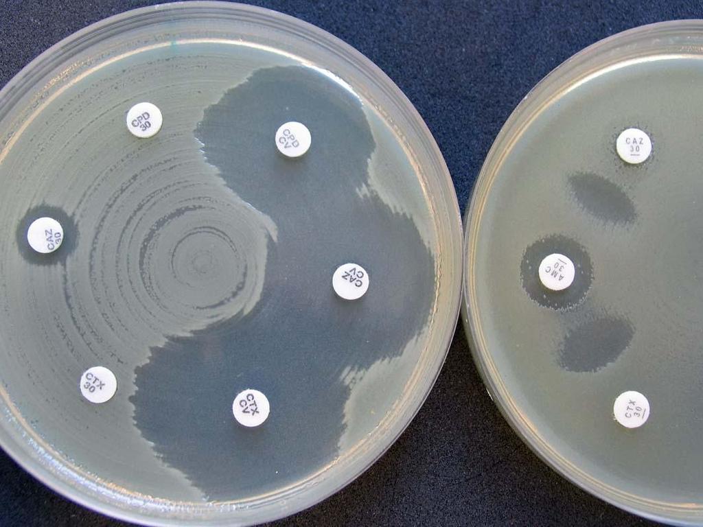 Frequency of E. coli ESBL among all E. coli blood isolates. HUSLAB material 2001-2013 E.