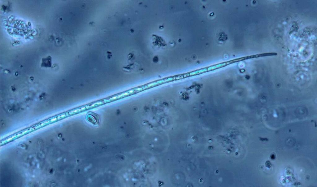 Kasviplanktonbiomassa on ollut,,9 g m -, runsaimmat lajit Ceratium hirundinella -panssarisiimalevä ja Acanthoceras zachariasii.