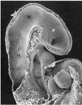 kehityspäivä): Prosenkefalonista telenkefalon ja dienkefalon,