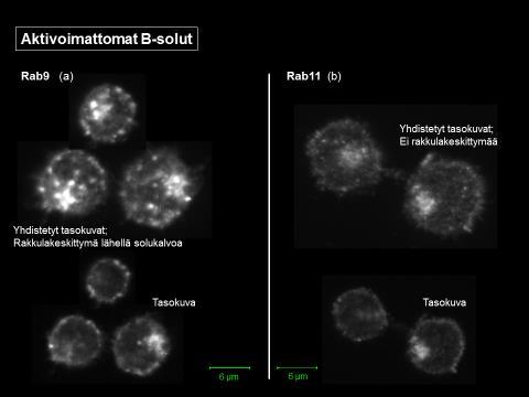 32 Kuva 11. Rab9 ja Rab11 aktivoimattomissa B-soluissa. Aktivoimattomissa B-soluissa EEA1-proteiinit (kuva 12 a) ovat hyvin epäaktiivisina eivätkä ne kasaannu Rab5/7/9 tavoin rakkulakeskittymään.