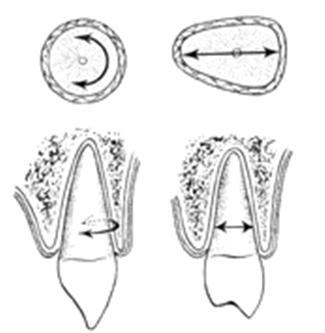molaarialueella linguaalinen luu ohuempaa Pihdin ohjaus hampaalle Pihtipoisto: oikeat otteet