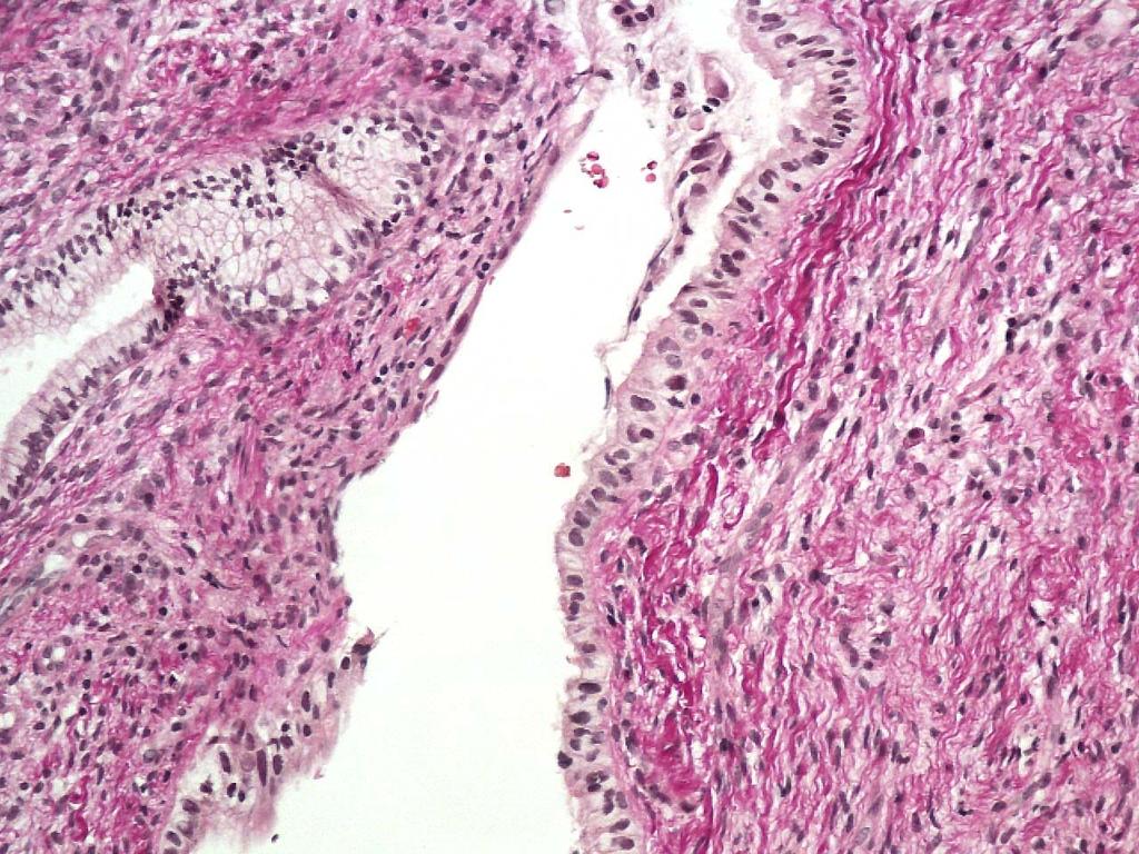 Histologisessa biopsiassa