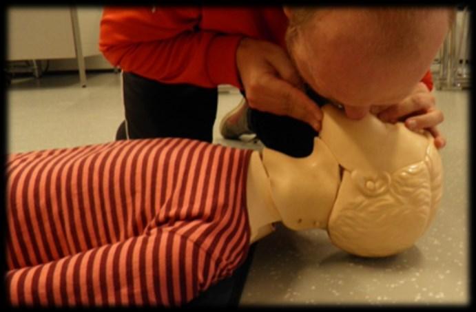 Lapsi ei hengitä tai hengitys ei ole normaalia Aloita lapsen painelu-puhalluselvytys (PPE) puhalluksella 1) Avaa hengitystie 2) Aseta