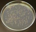 19 20 21 Yhdistelmä-DNA:n monistaminen bakteereissa Escherichia coli -bakteerin pesäkkeitä agaroosimaljalla Yhdistelmä-DNA (tyypillisesti plasmidi- DNA:na) siirretään bakteeriin