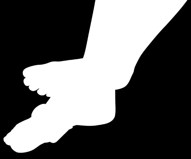 ValguLoc korjaa vaivaisenluun 3 tuki pisteen periaatteen mukaisesti ja venyttää kapselin ja pehmytkudoksen