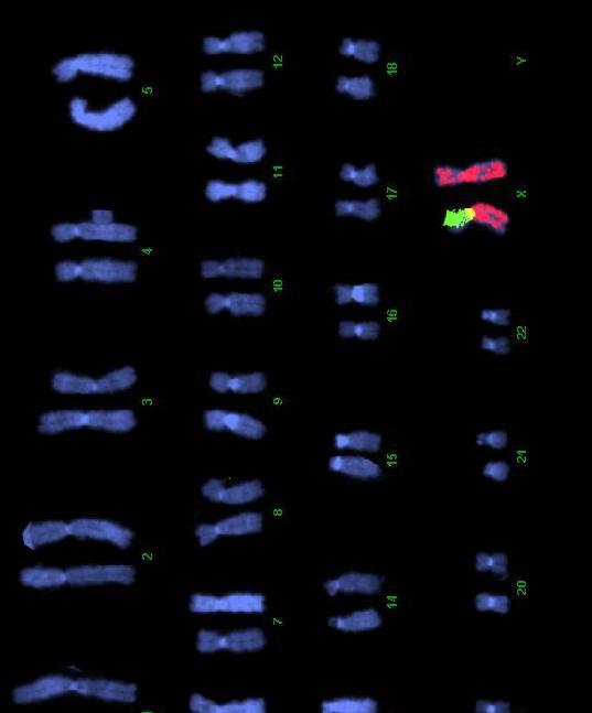 jokainen kromosomi värjäytyy eri väriseksi) rakenteeltaan poikkeavien kromosomien tutkiminen (esim.