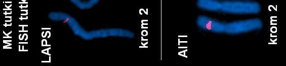 vanhempien kromosomien tutkiminen MK-tutkimus: potilaalla 11 Mb suuruinen duplikaatio 2p22.