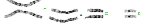 Kromosomityypit (käsivarsien suhteiden mukaan) Kromosomi 1 Kromosomi 4 Kromosomi 13 metasentrinen submetasentrinen akrosentrinen Metasentriset kromosomit: 1,3, 16, 19,20 Submetasentriset kromosomit: