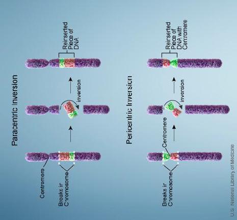 Balansoidut, tasapainoiset translokaatiot geeniainesta ei tule lisää eikä sitä häviä ei vaikuta fenotyyppiin voi meioosissa johtaa epätasapainoisen translokaation sisältävän sukusolun syntyyn, joka