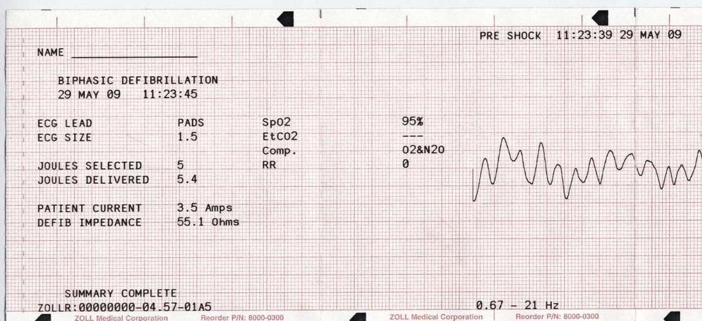 Siihen tulostuu myös valittu energia jouleina, annettu energia jouleina, mahdollisesti käytössä oleva synkronointi (mukaan lukien synkronointimerkit), EKG-kytkentä, EKG:n koko, käytetty virta,