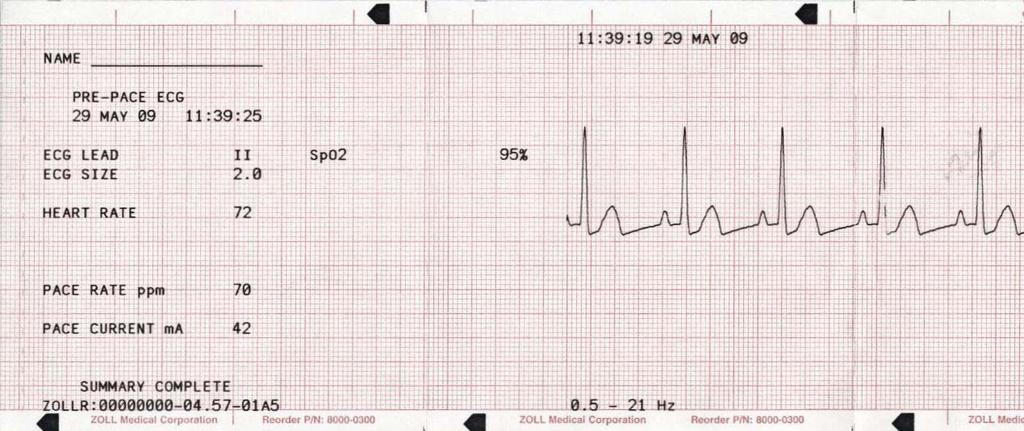 EKG-tiedot.
