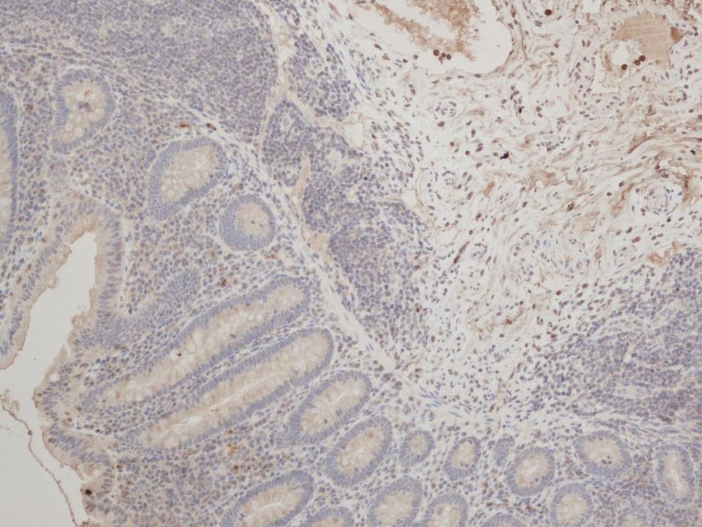 17 Rat Anti Human CD52 Rotasta saatu vasta-aine CD52 reagoi ihmisen CD52-antigeenin kanssa, joka on huomattavan pieni peptidi, jota ilmentyy voimakkaasti seuraavien solujen pinnalta: lymfosyytit,