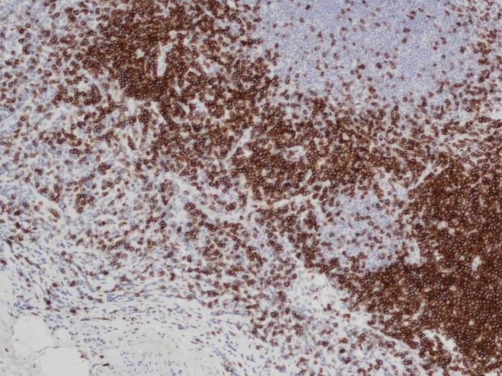 19 Novocastra TM Liquid Mouse Monoclonal Antibody CD7 T-solujen solukalvot. Tutkimuksissa on todistettu, että tällä antigeenilla ei ole reaktiivisuutta muissa kuin tämän solulinjan soluissa.