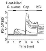 Nosiseptorit TRP (transient receptor potential)-ionikanavat ääreishermopäätteissä aistimassa lämpötilaa ja muita ärsykkeitä (kationikanavia => eksitoivat hermopäätteen) Dhaka et al.
