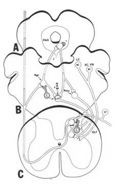 seuraava slide) Paksut myeliinitupelliset kosketussyyt (L) inhiboivat välineuronin (SG) kautta sentraaliseen kipusoluun (T)
