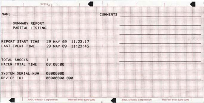 LUKU 10 TAPAHTUMAYHTEENVEDOT JA RAPORTIT Parametrihälytys. Mode Selector on säädetty tilaan PACER. Huomautus: Yhteenvetoraportti ei sisällä diagnostisen taajuusalueen tallenteita.