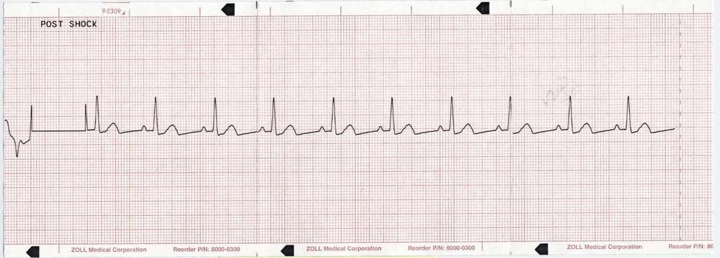 EKG:n koko, käytetty virta, potilaan impedanssi sekä tapahtuman kellonaika ja päivämäärä.