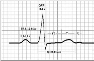 Angina pectoris-kipu Iskeeminen ST-väli EKG:ssä Vasemman kammion täyttöpaineen nousu ja hengenahdistus Poikkeava seinämän liike Huonontunut relaksaatio perfusion mismatch syketaajuus