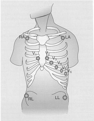 Kliininen rasituskoe; seurattavat suureet oireet (esim. hengenahdistus, rintakipu) hengitys- ja sydänäänet rasittavuustuntemus (Borgin asteikko) syketaajuus (maksimi yleensä n.