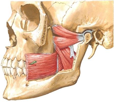 pterygoideus lateralis lähtee fossa infratemporalessa kitaluun ulokkeista, syyt kulkevat mediaali- ja anteriori-suunnasta niveltä kohti, kiinnittyy nivelkapseliin ja välilevyyn sekä nivelulokkeeseen.