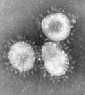 Alphacoronavirus: 229E, NL63
