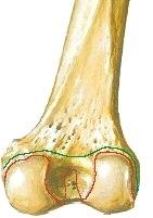 Retinaculum patellae mediale et laterale sitovat polvilumpiota sivusuunnassa Sisäiset nivelsiteet ja rakenteet: Polven nivelkierukat (meniscus et ) sovittavat nivelpintoja toisiinsa.