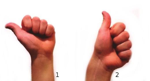 124 Kuvio 18. A. Kuvio 19. S. Esimerkiksi viittomalla MIES on vähintään kaksi käsimuotovarianttia: A-käsimuoto (kuvio 18) tai S-käsimuoto (kuvio 19).