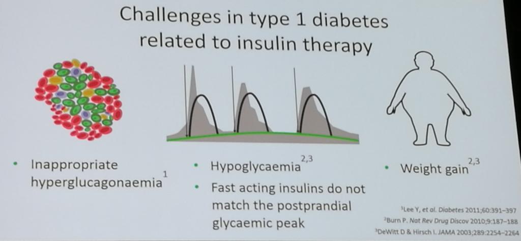 treated people w T1D. EASD 2017. OP25, 150.