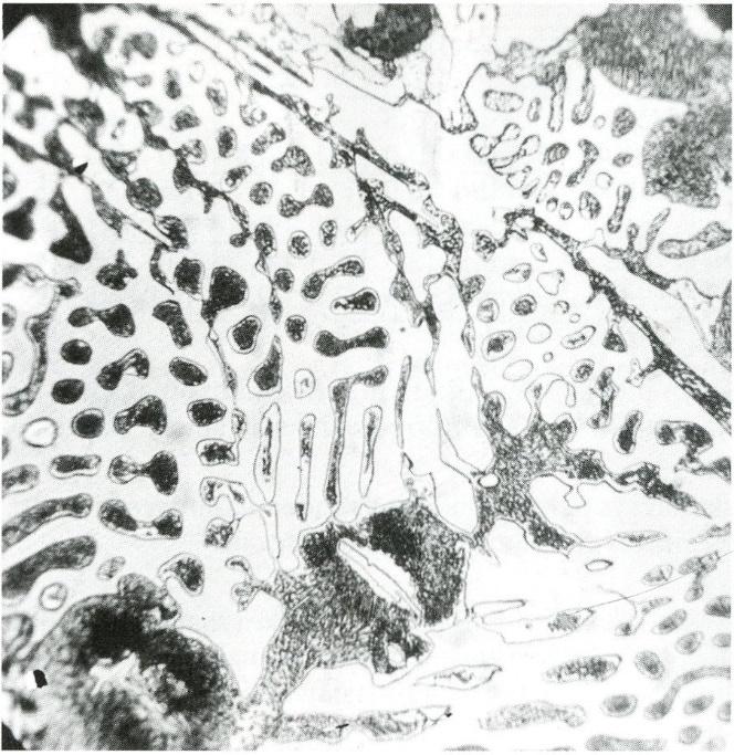 18 Kuva 6. Seostamattoman valkoisen valuraudan mikrorakenne. Sementiitti näkyy kuvassa valkoisena ja perliitti tummana. (Silvennoinen 2001, s.