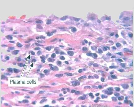 Histologinen värjäys (HE) 1) Hematoksyliini on sininen väriaine.