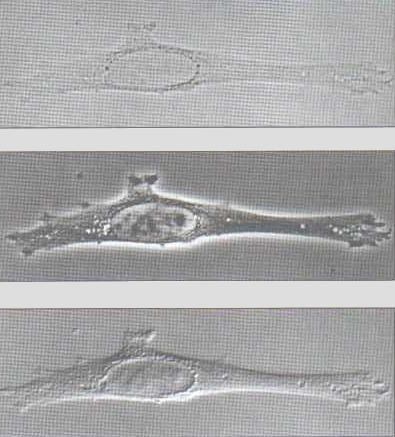Histologinen valmiste Viljelty solu valomikroskoopissa Sama solu vaihevastakohta valomikroskoopissa Sama interferenssi (Nomarski)-optiikalla Solu ilman