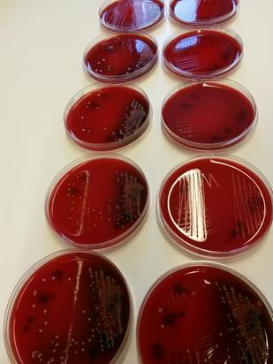 31 Kuvio 21. P. melaninogenica säilytettynä eswab - (vas.) ja PLAT -nestekuljetusputkessa (oik.) jääkaappilämpötilassa säilytettynä.