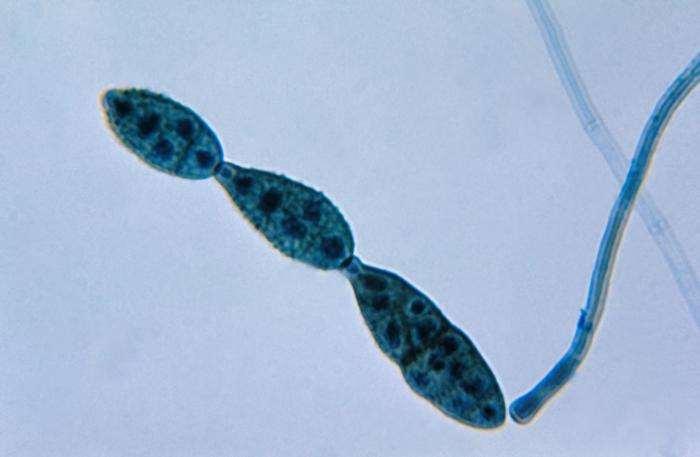 8 3.2 Alternaria sp. ja Alternaria alternata Alternaria-suvun homeet ovat nopeakasvuisia ja ne kuuluvat Ascomycota-kaareen. Alternaria alternata -lajin kuvasi F. Keissler vuonna 1912.