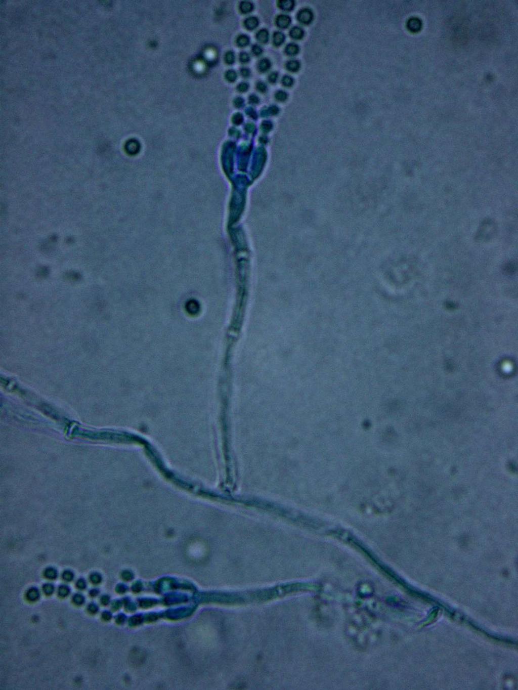 14 Kuva 6. Penicillium sp. (59). 3.9 Stachybotrys chartarum Vuonna 1818 Ehrenberg kuvasi Stachybotrys chartarum -lajin nimellä Stilbospora chartarum ja vuonna 1958 S.