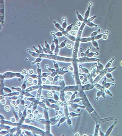 16 Kuva 7. Trichoderma harzianum (72). 3.10.4 Trichoderma viride Trichoderma viride -lajin kuvasi C.H. Persoon vuonna 1794. Laji on nopeakasvuinen ja sen esiintyminen viittaa kosteusvaurioon.
