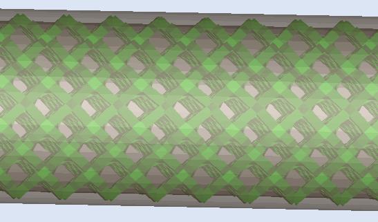 Näistä varsinaisia ristikkomaisia rakenteita ovat X, Grid, Star ja Hexagonial. (Within Medical ohjelma 2014.
