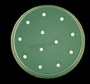 12 3 KÄYTÖSSÄ OLEVAT MENETELMÄT Antibioottiresistenssin arviointiin on kehitetty useita menetelmiä. Nykyisin pyritään kehittämään seulonta- ja arviointimenetelmiä antibioottien aktiivisuudelle.