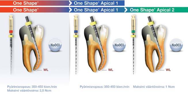One Shape Apical Viimeistelijät One Shape -apikaaliviilat ovat steriilejä kertakäyttöisiä instrumentteja, joilla juurikanavaa voidaan laajentaa apikaalisesti sen jälkeen, kun kanava on muotoiltu One