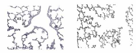 A B AS AI C 24 rv 32 rv 40 rv 6 kk Alveoli Alveolikäytävä KUVA 2. A) Alveolikäytävät (alveolar sacculus, AS) pikkukeskosella. B) Keuhkorakkulat (alveoli, AI) imeväisikäisellä.