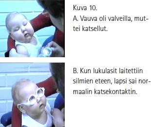 Miksi opiskella havaitsemista? Normaalin vuorovaikutuksen ja kehityksen edellytyksenä on normaalit aistitoiminnot.