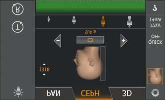 5 Käyttö Sirona Dental Systems GmbH 5.1 Röntgenkuvaus Käyttöohje ORTHOPHOS SL 2D / 3D 5.1.2.5.5 Quickshot-toiminnon asettaminen A Voit määrittää kutakin CEPH-ohjelmassa, onko Quickshot-toiminto käytössä vai ei.