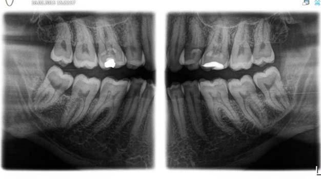 Sirona Dental Systems GmbH Käyttöohje ORTHOPHOS SL 2D / 3D 5 Käyttö 5.1 
