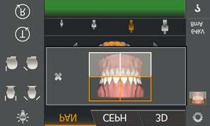 5 Käyttö Sirona Dental Systems GmbH 5.1 Röntgenkuvaus Käyttöohje ORTHOPHOS SL 2D / 3D 5.1.2.1.4 Neljännesten asettaminen A Kuvaus voidaan rajata neljänneksiin.